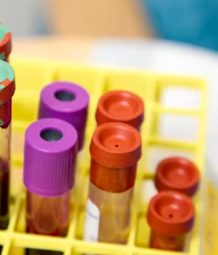 콜레스테롤 낮추는 방법 음식 과일