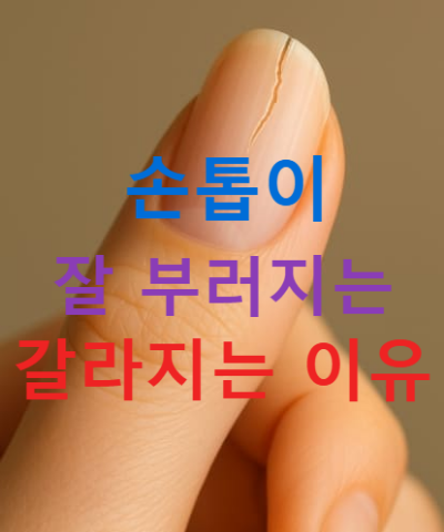 손톱이 잘 부러지는 이유와 갈라지는 이유