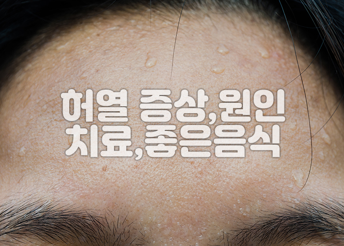 한사람의 이마에 땀이 맺혀 있다