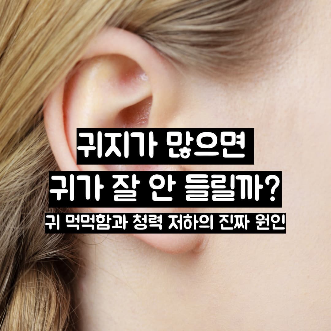 귀지가 많으면 귀가 잘 안 들릴까? 귀 먹먹함과 청력 저하의 진짜 원인