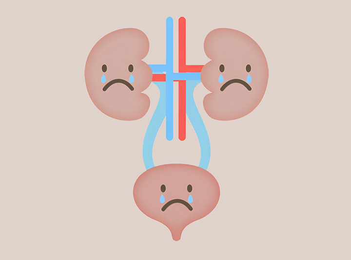 염증이-있는-신장의-모습