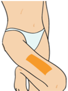 대퇴부 타박의 근육 테이핑 요법