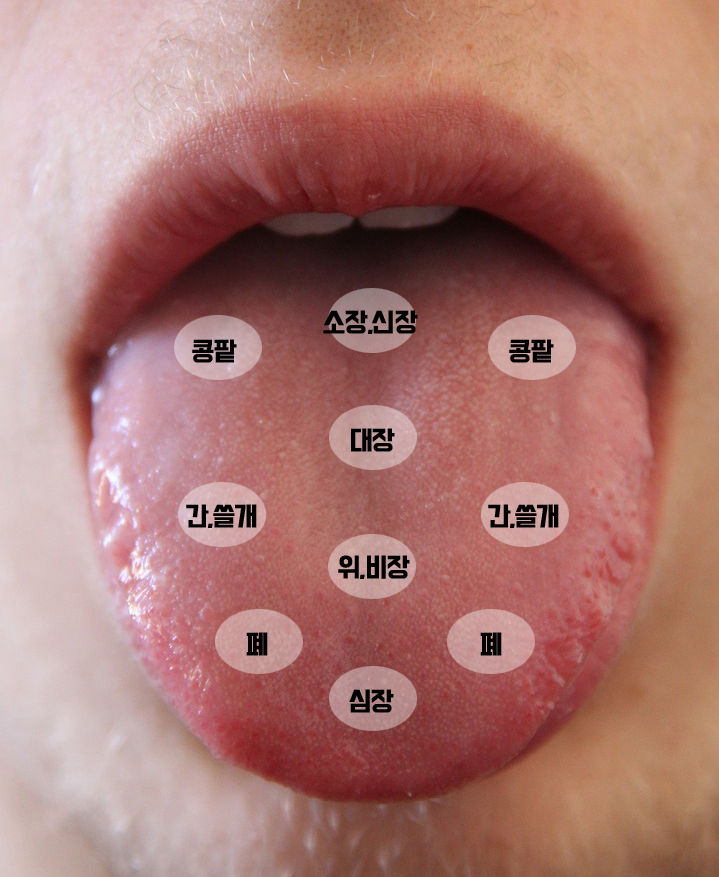 혀 이상부위에 따른 건강상태