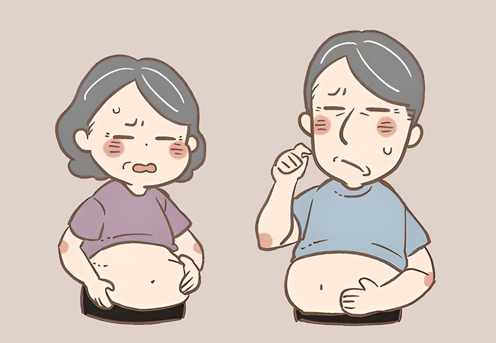 비만이-심한-부부