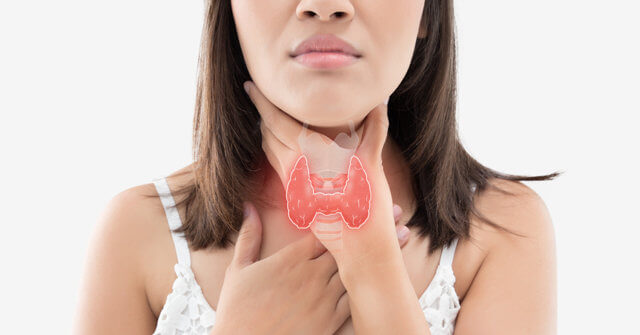 갑상선암 증상