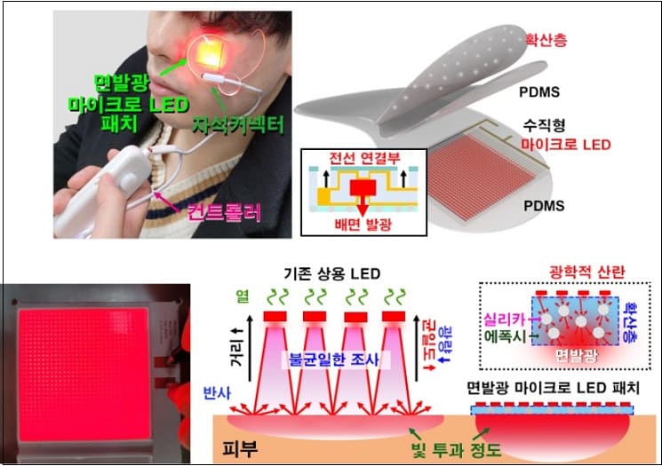 카이스트, 피부 미백에 획기적 효과 '면 발광 마이크로 LED 패치' 개발