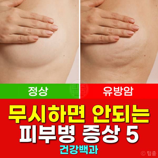 피부병 증상 유방암 당뇨병 갑상선 엽산결핍 혀암 글루텐과민증