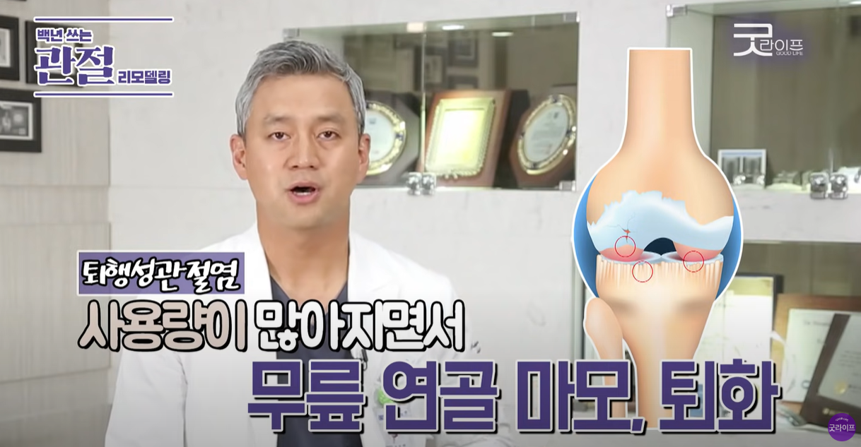 무릎 사용량이 많이지면 연골이 마모됩니다.