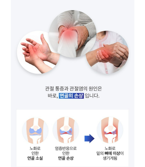건강한 사람의 무릎 관절 구조를 보여주는 3D 의학 일러스트. 뼈 사이의 연골이 콘드로이친 성분으로 보호받고 있는 모습을 시각화함