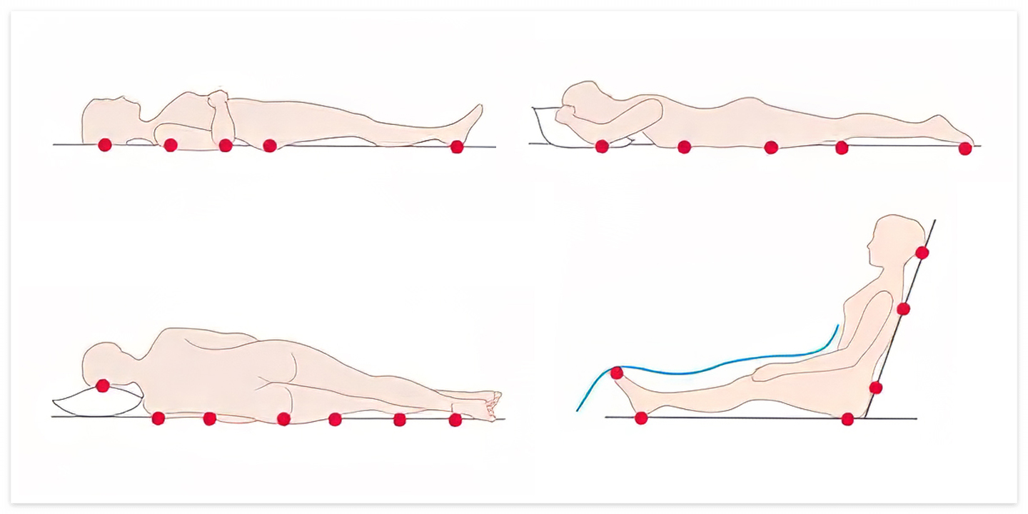 욕창이 생기는 부위