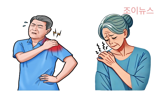 오십견(유착성 관절낭염)