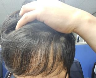 머리를 쓸어올린 모습