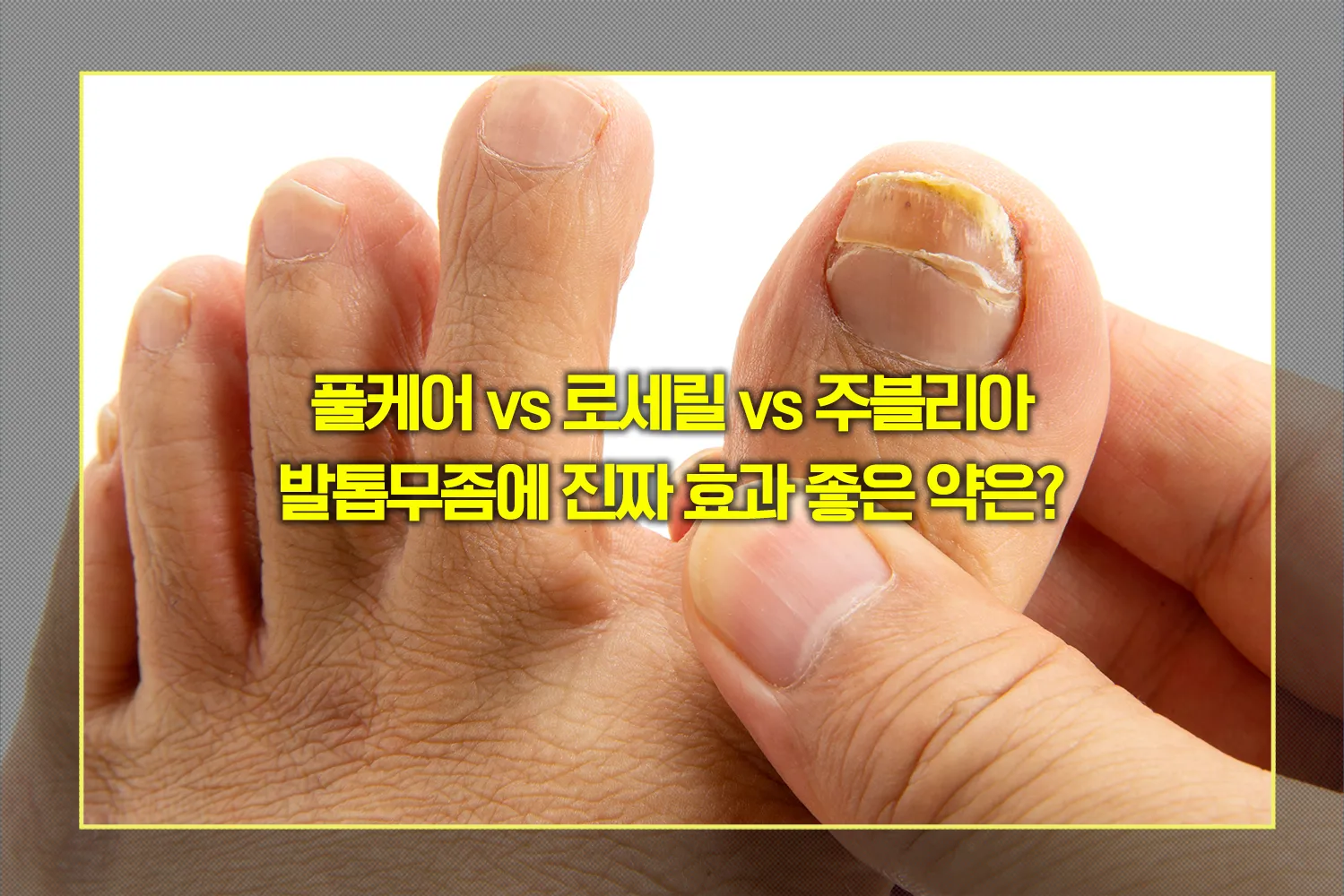 발톱무좀약-비교-추천
