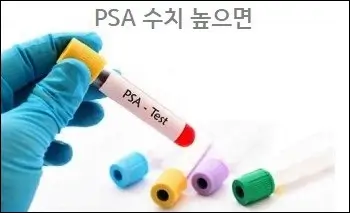 PSA 수치 높으면