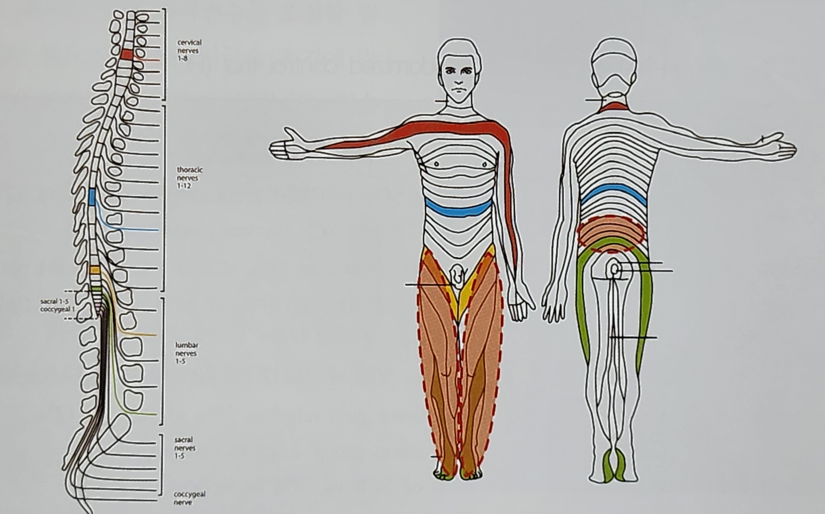 신경자극술 및 약물펌프를 이용한 약물주입치료(2)
