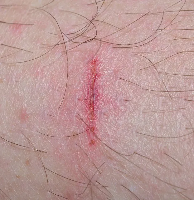 병풀 상처연고 상처 치유 피부 재생 효능과 사용법_7