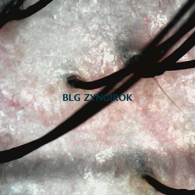 피나모아 복용 12주차 두피 사진 - 뒷머리 부분 모습이다.