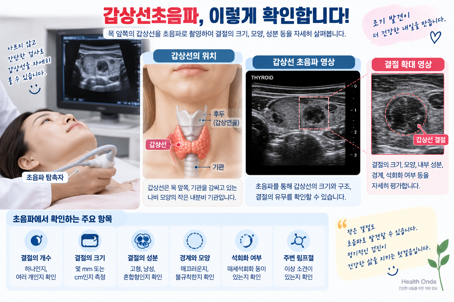 갑상선초음파의 검사 위치와 결절 평가 항목을 설명하는 인포그래픽
