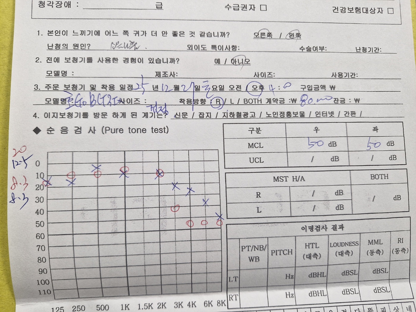 히어닷컴(Hear.com)보청기 1달 무료 체험 후기 제8화