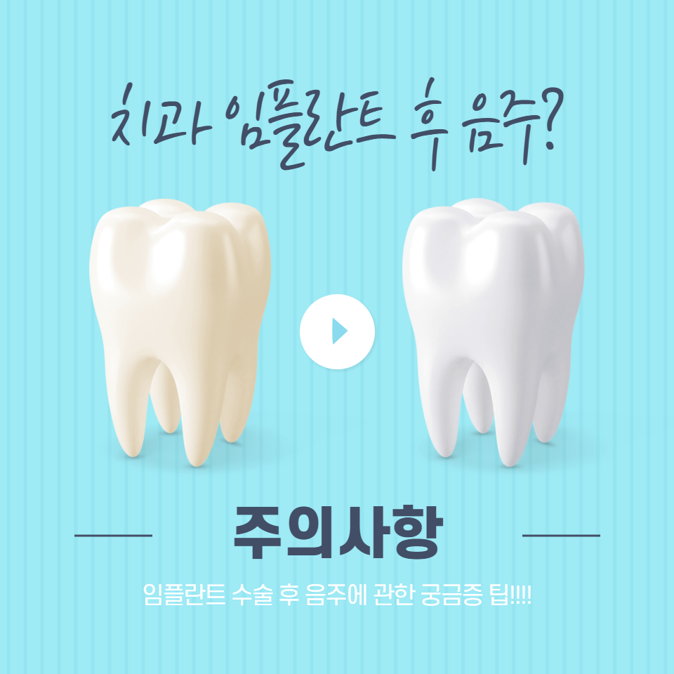 임플란트에 대한 안전한 음주 지침과 전문가의 조언을 통해 건강하고 안전한 생활을 유지하세요