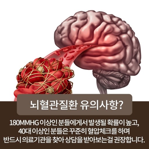 뇌졸중 전조증상과 체크리스트 및 예방과 치료