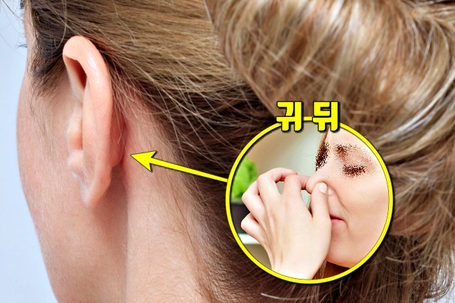 세균 많은 곳 신체부위,귀 뒤