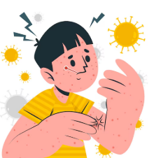 대상포진 초기증상, 주요증상, 초기 대응방법