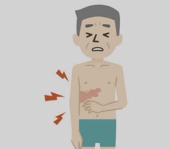 대상포진 초기증상 치료방법 예방법 총정리