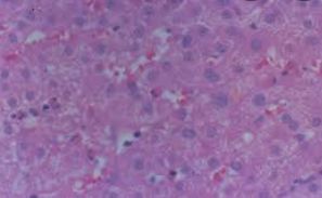 호중구 정상수치