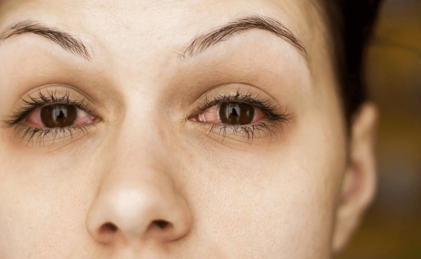 눈안에-이물질이-느껴질때