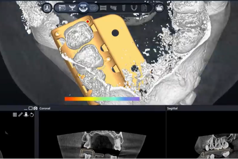 네오 바로가이드