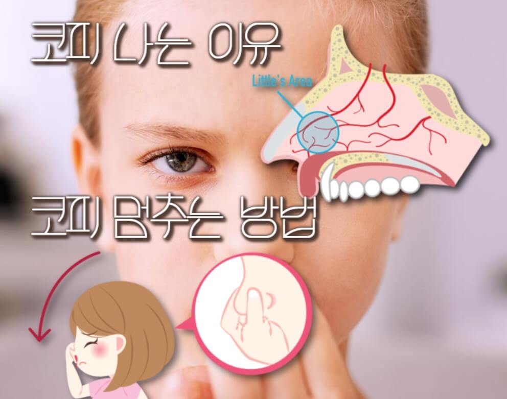 코피 나는 이유를 설명하는 그림