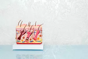 두피-지루성-피부염-치료