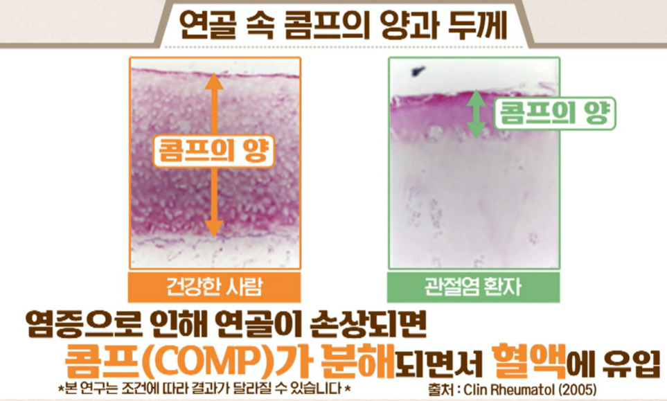 가자추출물 효능