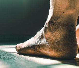 무좀 증상 치료법 원인 발톱 손톱