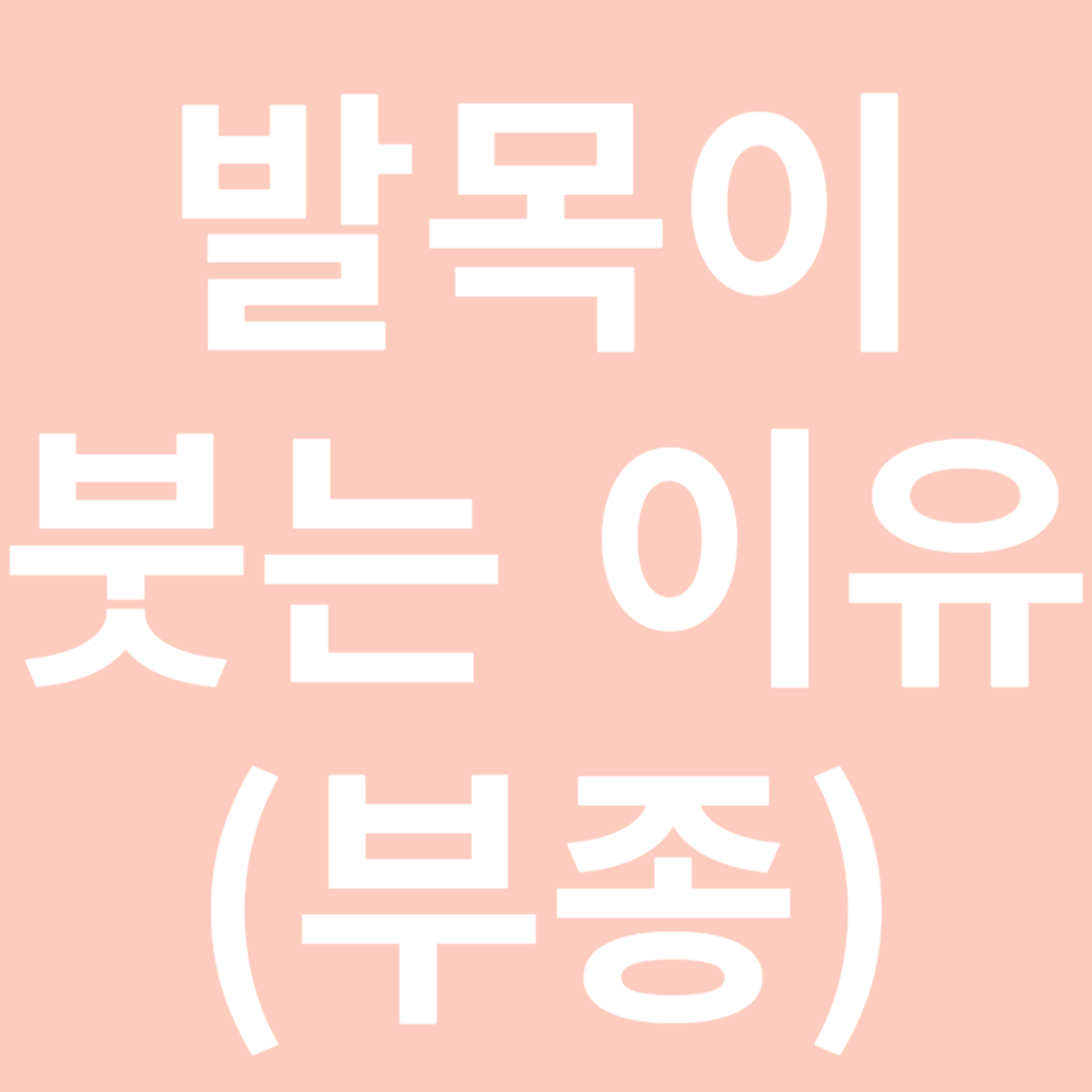 발목이 붓는 이유-썸네일