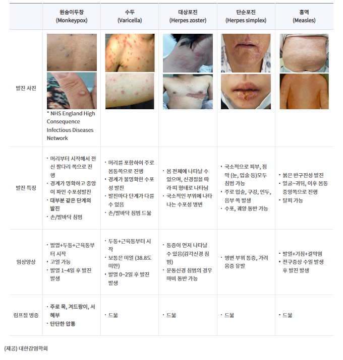 엠폭스와_다른_피부질환의_차이점