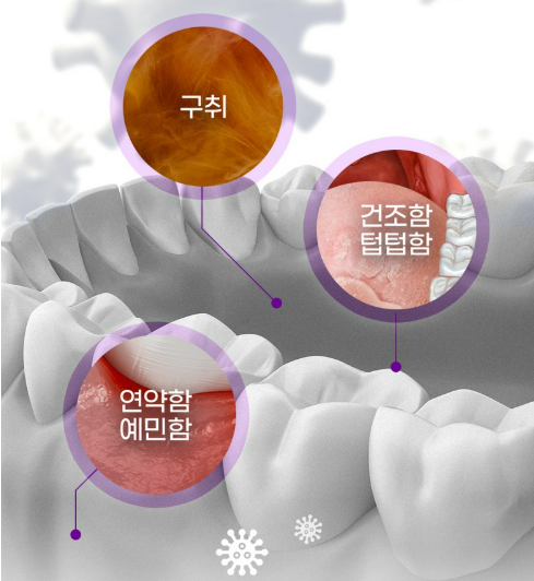 건강하고 깨끗한 잇몸과 치아를 보호하는 유익균의 모습을 시각화한 3D 일러스트입니다. 구강유산균 섭취를 통해 입속 세균 밸런스가 맞춰져 입냄새 원인이 제거되고 상쾌해진 아침의 느낌을 표현했습니다.