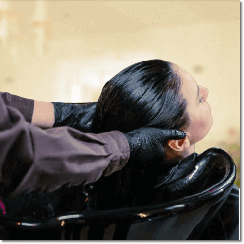 다낭성난소증후군 털 문제