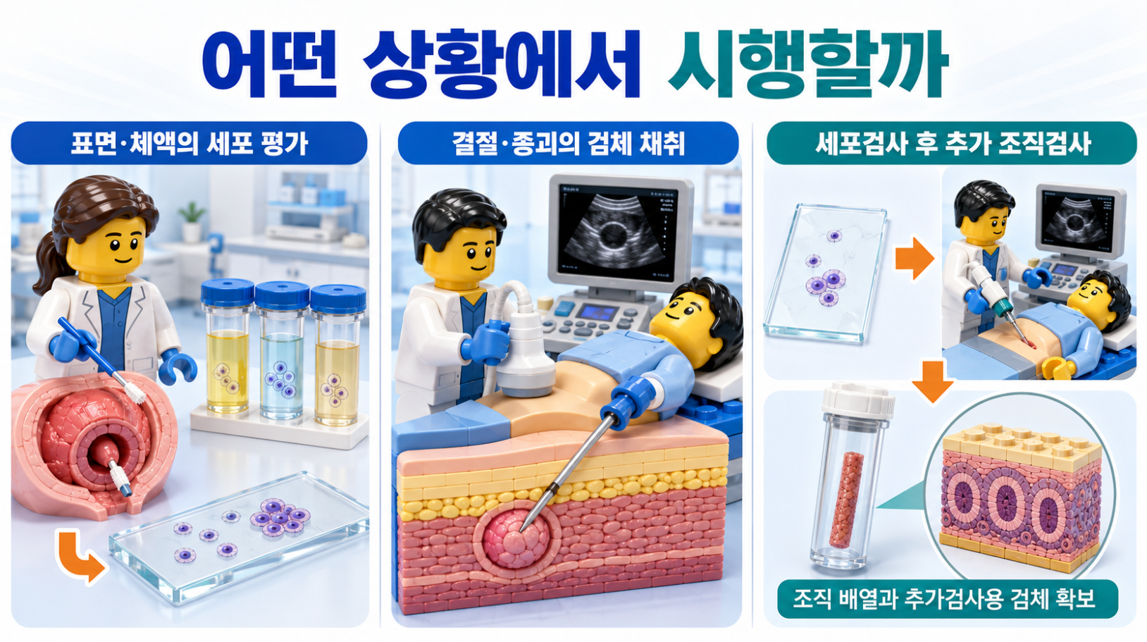 표면&middot;체액의 세포 평가와 결절&middot;종괴 검체 채취, 세포검사 후 추가 조직검사가 시행되는 상황을 설명한 의료 인포그래픽
