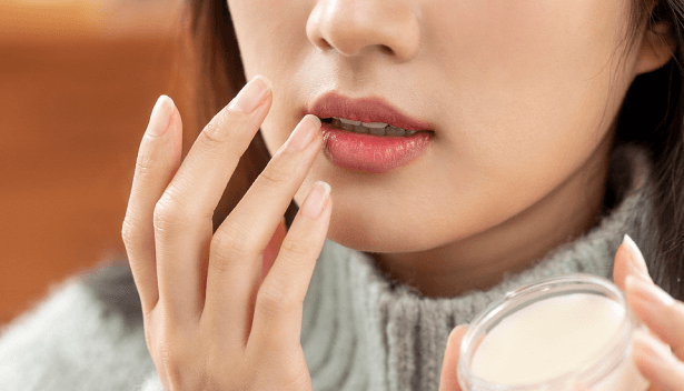 입술물집(헤르페스 1형)