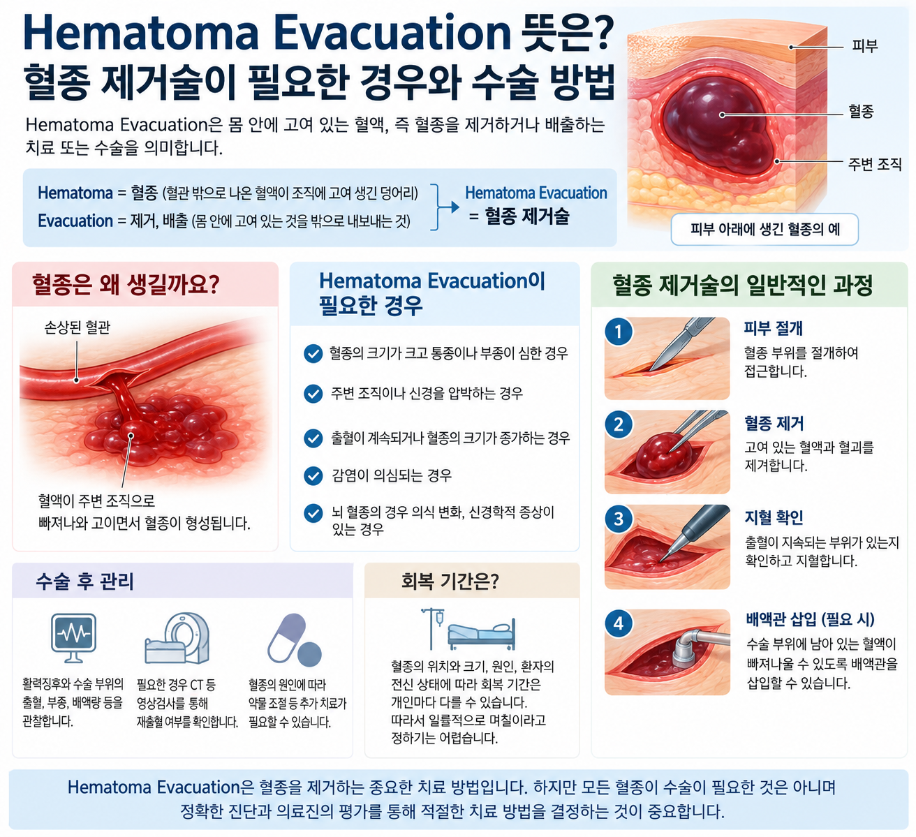 혈종 제거술이 필요한 경우와 수술 방법