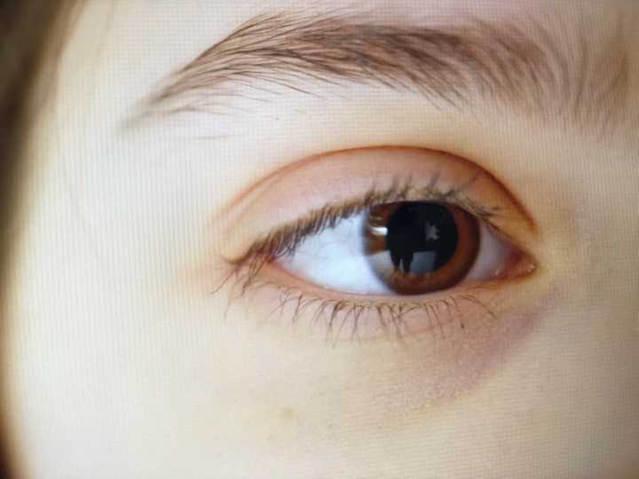눈