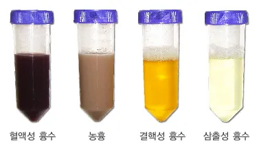 폐에 물이 차는 원인 증상 물참 관리 포인트에 대한 건강정보_8
