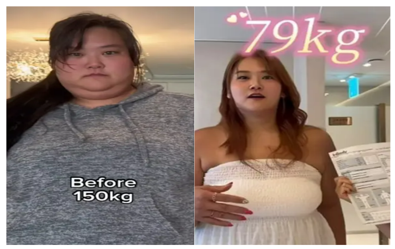 미나 시누이 박수지, 72kg 감량 성공