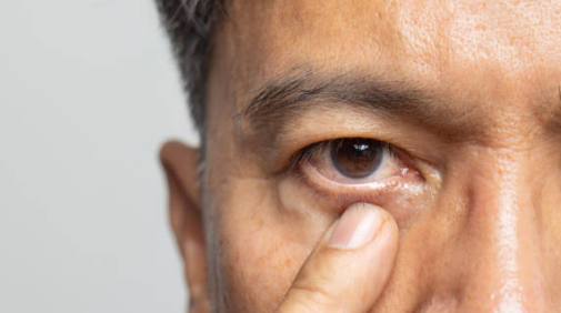 백내장 증상&amp;#44; 수술비용&amp;#44; 수술후 시력회복 기간 총정리 (2024ver)