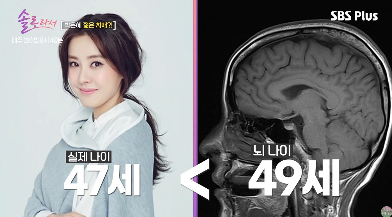 박은혜 치매