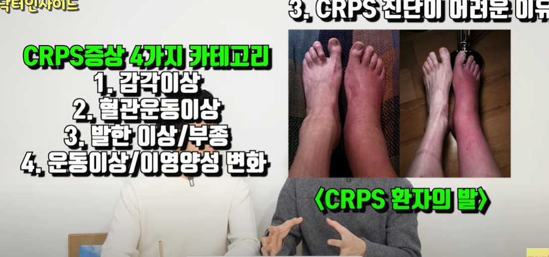 CRPS 복합부위 통증 증후군 치료 및 원인 (+ 1형 장애등급)