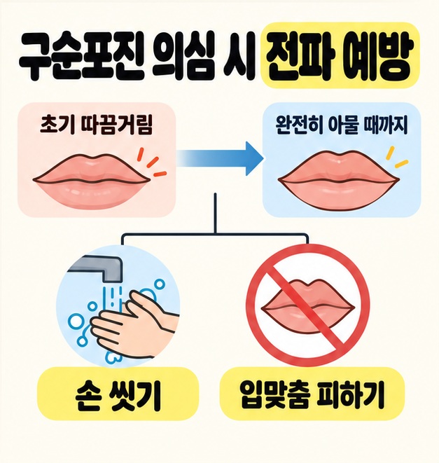 초기 따끔거림부터 완전히 아물 때까지의 기간 아래 손 씻기와 입맞춤 피하기를 연결한 구순포진 전파 예방 도식