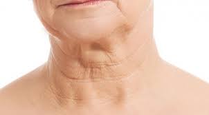 목주름 없애는 비결